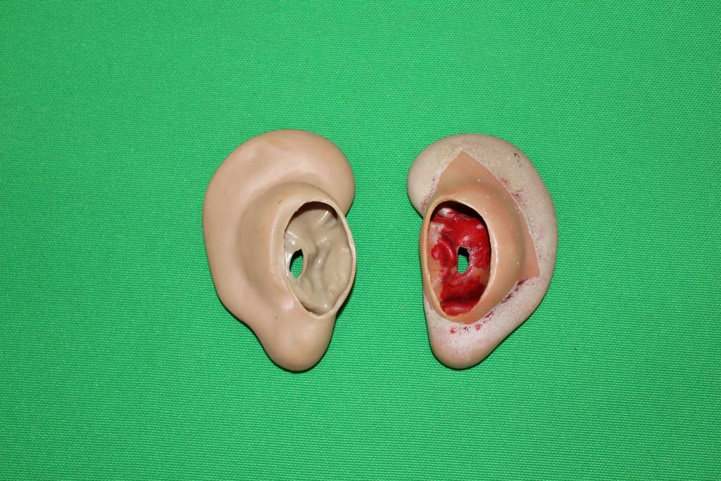 Human Ears