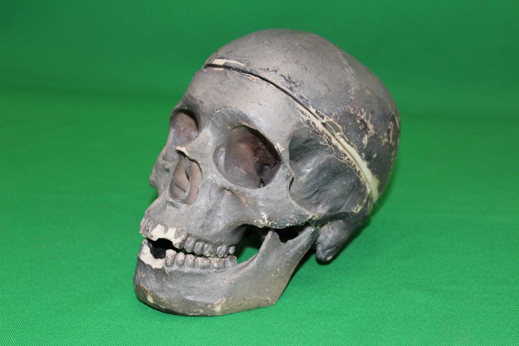Human Skull