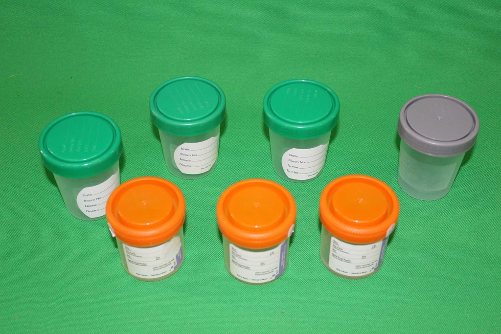 Urine Sample Cups